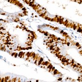 Anti-Ki67 Antibody, clone 5P6N6, Rabbit Monoclonal