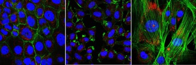 Anti-ARHGEF6 from rabbit, purified by affinity chromatography