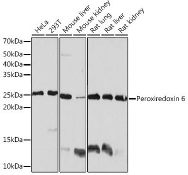 Anti-Peroxiredoxin 6 Antibody, clone 1A9W5, Rabbit Monoclonal