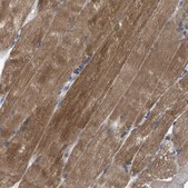 Anti-HSPB8 antibody produced in rabbit Prestige Antibodies® Powered by Atlas Antibodies, affinity isolated antibody, buffered aqueous glycerol solution