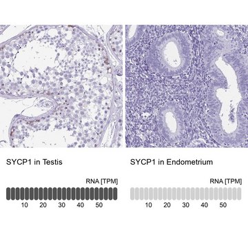 Anti-SYCP1 antibody produced in rabbit Prestige Antibodies&#174; Powered by Atlas Antibodies, affinity isolated antibody, buffered aqueous glycerol solution