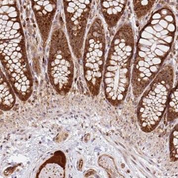 Anti-SMOX antibody produced in rabbit Prestige Antibodies&#174; Powered by Atlas Antibodies, affinity isolated antibody, buffered aqueous glycerol solution