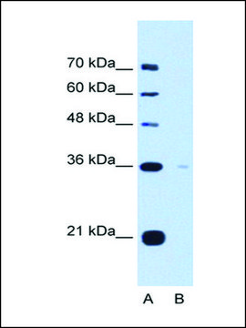 Anti-TOR1B antibody produced in rabbit IgG fraction of antiserum