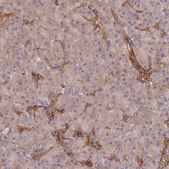 Anti-ARRDC1 antibody produced in rabbit Prestige Antibodies® Powered by Atlas Antibodies, affinity isolated antibody, buffered aqueous glycerol solution