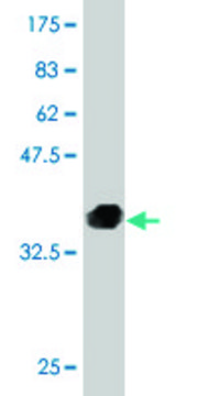 Monoclonal Anti-AXL antibody produced in mouse clone 6C8, purified immunoglobulin, buffered aqueous solution