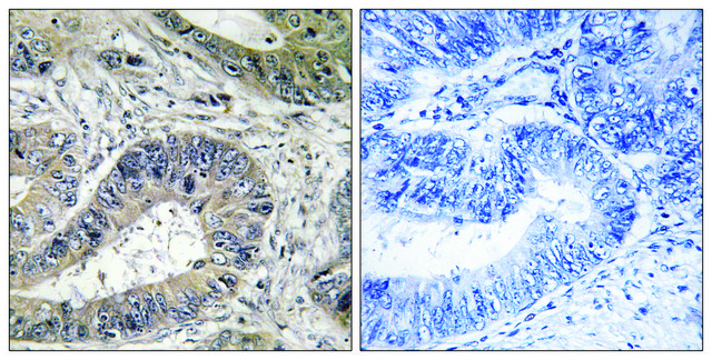 Anti-ERN2 antibody produced in rabbit affinity isolated antibody