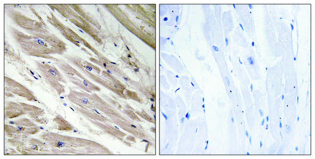 Anti-MYBPC3 antibody produced in rabbit affinity isolated antibody