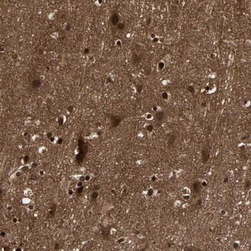 Anti-NTRK2 antibody produced in rabbit Prestige Antibodies&#174; Powered by Atlas Antibodies, affinity isolated antibody, buffered aqueous glycerol solution