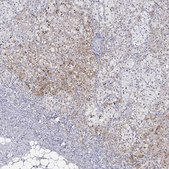 Anti-DLK1 antibody produced in rabbit Prestige Antibodies® Powered by Atlas Antibodies, affinity isolated antibody, buffered aqueous glycerol solution