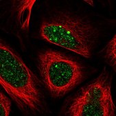 Anti-ALKBH8 antibody produced in rabbit Prestige Antibodies® Powered by Atlas Antibodies, affinity isolated antibody, buffered aqueous glycerol solution