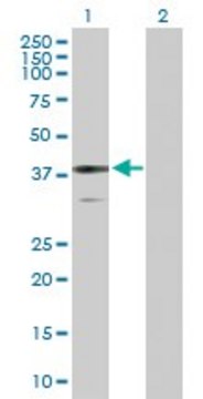 Anti-BDH1 antibody produced in rabbit purified immunoglobulin, buffered aqueous solution