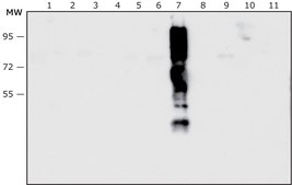 Anti-Pseudomonas aeruginosa antibody produced in rabbit IgG fraction of antiserum