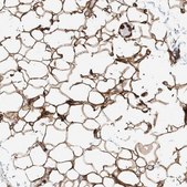 Anti-PKD1L1 antibody produced in rabbit Prestige Antibodies® Powered by Atlas Antibodies, affinity isolated antibody, buffered aqueous glycerol solution, Ab2