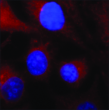 Anti-SDCBP antibody produced in rabbit ~1.0&#160;mg/mL, affinity isolated antibody, buffered aqueous solution