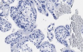 Anti-MR-proADM Antibody, clone 2B19 ZooMAb® Rabbit Monoclonal recombinant, expressed in HEK 293 cells