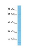 Anti-AMFR antibody produced in rabbit IgG fraction of antiserum