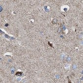 Anti-MECR antibody produced in rabbit Prestige Antibodies® Powered by Atlas Antibodies, affinity isolated antibody, buffered aqueous glycerol solution, Ab2