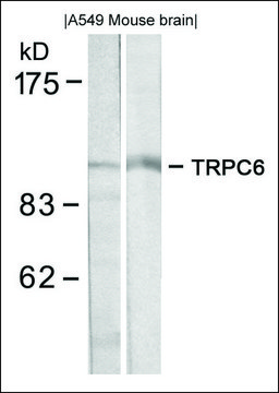 Anti-TRPC6 antibody produced in rabbit affinity isolated antibody