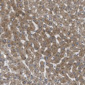 Anti-SSR1 antibody produced in rabbit Prestige Antibodies® Powered by Atlas Antibodies, affinity isolated antibody, buffered aqueous glycerol solution