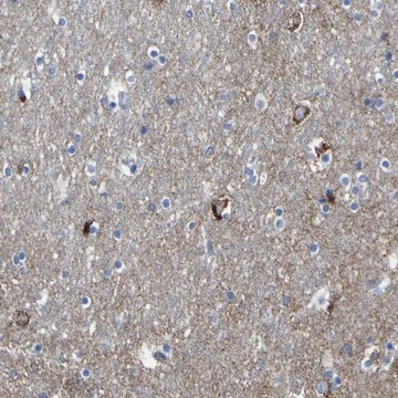 Anti-HK1 antibody produced in rabbit Prestige Antibodies&#174; Powered by Atlas Antibodies, affinity isolated antibody, buffered aqueous glycerol solution