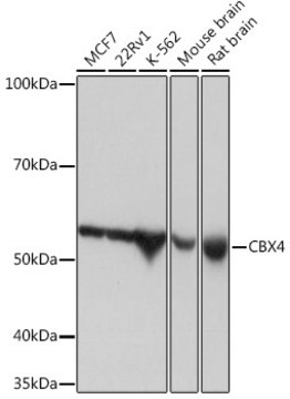 Anti-CBX4 Antibody, clone 1R5G6, Rabbit Monoclonal