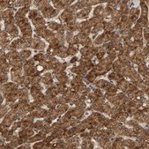 Anti-GSTK1 antibody produced in rabbit Prestige Antibodies® Powered by Atlas Antibodies, affinity isolated antibody, buffered aqueous glycerol solution