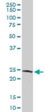 Anti-GSTZ1 antibody produced in rabbit purified immunoglobulin, buffered aqueous solution