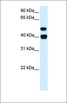 Anti-USP22 (ab1) antibody produced in rabbit affinity isolated antibody