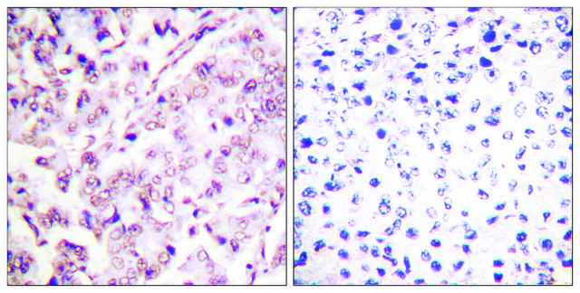 Anti-phospho-ETS1 (pThr38) antibody produced in rabbit affinity isolated antibody