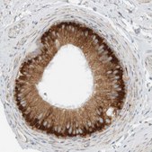 Anti-RPN2 antibody produced in rabbit Prestige Antibodies® Powered by Atlas Antibodies, affinity isolated antibody, buffered aqueous glycerol solution