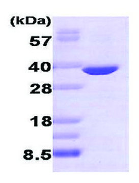 醛糖还原酶 人 recombinant, expressed in E. coli, &#8805;95% (SDS-PAGE)