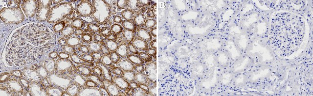 Anti-iRhom2/RHBDF2 Antibody, clone 1F17 ZooMAb&#174; Rabbit Monoclonal recombinant, expressed in HEK 293 cells