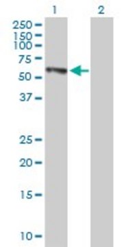 Anti-EPHX2 antibody produced in mouse IgG fraction of antiserum, buffered aqueous solution