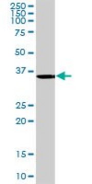 Anti-ANKRA2 antibody produced in rabbit purified immunoglobulin, buffered aqueous solution