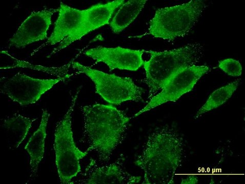 Monoclonal Anti-YKT6, (C-terminal) antibody produced in mouse clone 1F8, purified immunoglobulin, buffered aqueous solution