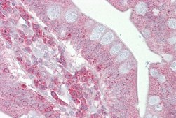 Anti-PSEN1 antibody produced in rabbit affinity isolated antibody