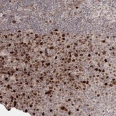 Anti-KIF20A antibody produced in rabbit Prestige Antibodies® Powered by Atlas Antibodies, affinity isolated antibody, buffered aqueous glycerol solution