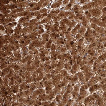 Anti-PGM1 antibody produced in rabbit Prestige Antibodies&#174; Powered by Atlas Antibodies, affinity isolated antibody, buffered aqueous glycerol solution, Ab2