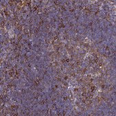 Anti-ADAMTSL2 antibody produced in rabbit Prestige Antibodies® Powered by Atlas Antibodies, affinity isolated antibody, buffered aqueous glycerol solution