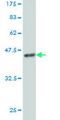 Monoclonal Anti-MS4A1 antibody produced in mouse clone 5C11, purified immunoglobulin, buffered aqueous solution
