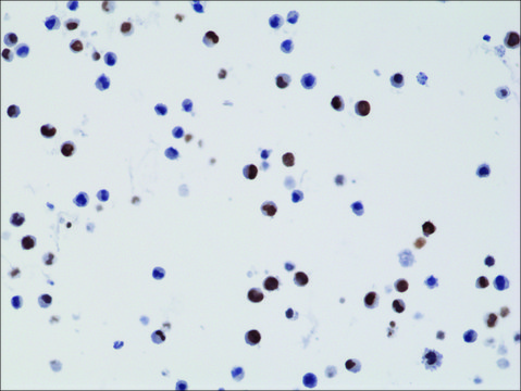 兔抗组蛋白H3 K27M单克隆抗体 recombinant, expressed in HEK 293 cells, clone RM192, purified immunoglobulin