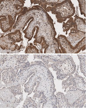 Anti-LGMN/AEP Antibody, clone 6E3