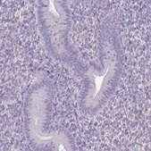 Anti-SLC30A3 antibody produced in rabbit Prestige Antibodies&#174; Powered by Atlas Antibodies, affinity isolated antibody, buffered aqueous glycerol solution