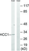 Anti-HCC1 antibody produced in rabbit affinity isolated antibody