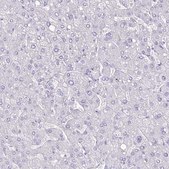 Anti-UBA6 antibody produced in rabbit Prestige Antibodies® Powered by Atlas Antibodies, affinity isolated antibody, buffered aqueous glycerol solution