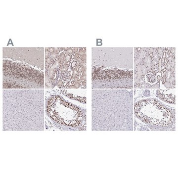 Anti-SIN3A antibody produced in rabbit Prestige Antibodies&#174; Powered by Atlas Antibodies, affinity isolated antibody, buffered aqueous glycerol solution