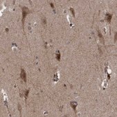 Anti-TANC2 antibody produced in rabbit Prestige Antibodies® Powered by Atlas Antibodies, affinity isolated antibody, buffered aqueous glycerol solution