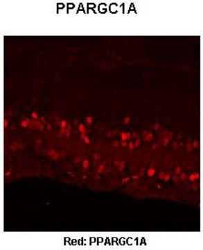 Anti-PPARGC1A affinity isolated antibody