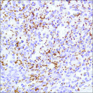 Anti-CD42B antibody, Rabbit monoclonal clone SP219, recombinant, expressed in proprietary host, affinity isolated antibody