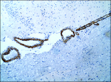 Anti-ASAP1/Centaurin β4 (ED-20) antibody produced in rabbit IgG fraction of antiserum, buffered aqueous solution
